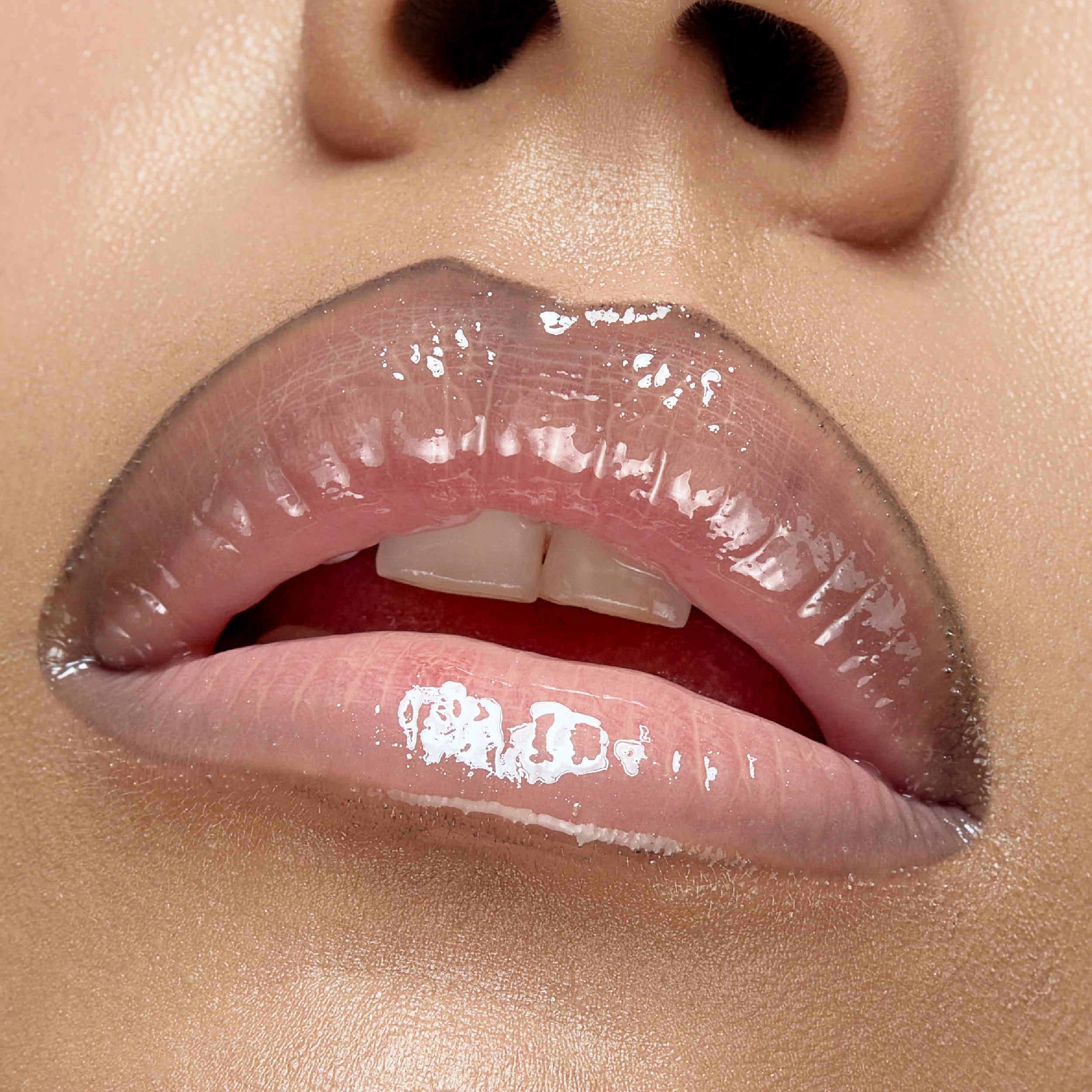 LABIOS